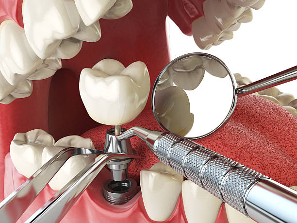 Best Dental Abscess Treatment in Cadillac, MI